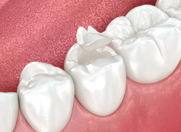 Professional  Dental Services in Cinco Ranch, TX